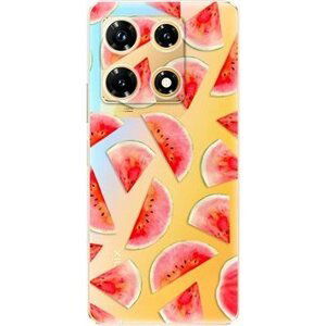 iSaprio Melon Pattern 02 – Infinix Note 30 PRO