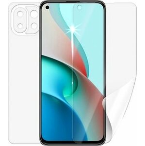 Screenshield pre XIAOMI Mi 11 Lite 5G na celé telo