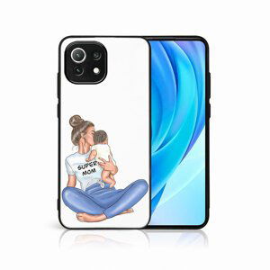 PROTEMIO 48881
MY ART Ochranný kryt Xiaomi Mi 11 Lite / 11 Lite 5G / 11 Lite NE 5G-SUPERMOM (112)