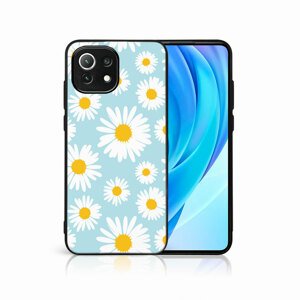 PROTEMIO 48897
MY ART Ochranný kryt Xiaomi Mi 11 Lite / 11 Lite 5G / 11 Lite NE 5G -CAMOMILE (124)