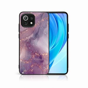 PROTEMIO 48973
MY ART Ochranný kryt Xiaomi Mi 11 Lite / 11 Lite 5G / 11 Lite NE 5G -PURPLE (148)